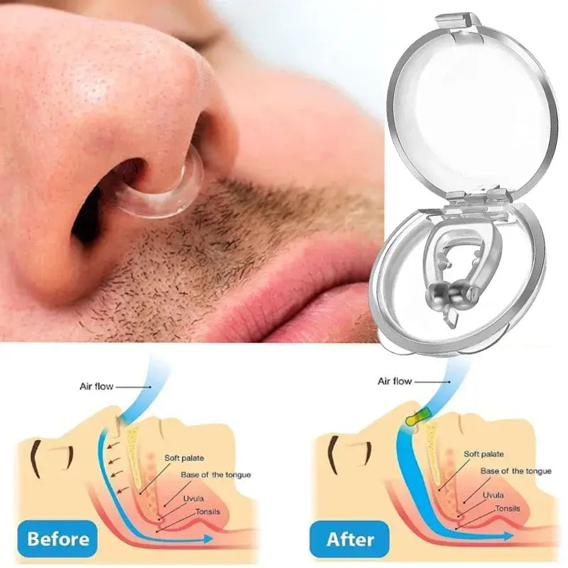 Anti-Snoring Nose Clip