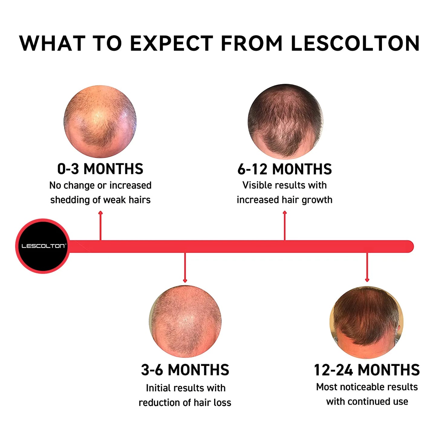 Laser Infrared Hair Growth Helmet - LESCOLTON®